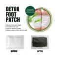 Korea KINOKI Gold or White Foot Pads-6